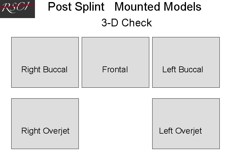 Post Splint Mounted Models 3 -D Check Right Buccal Right Overjet Frontal Left Buccal Post Splint Mounted Models 3 -D Check Right Buccal Right Overjet Frontal Left Buccal