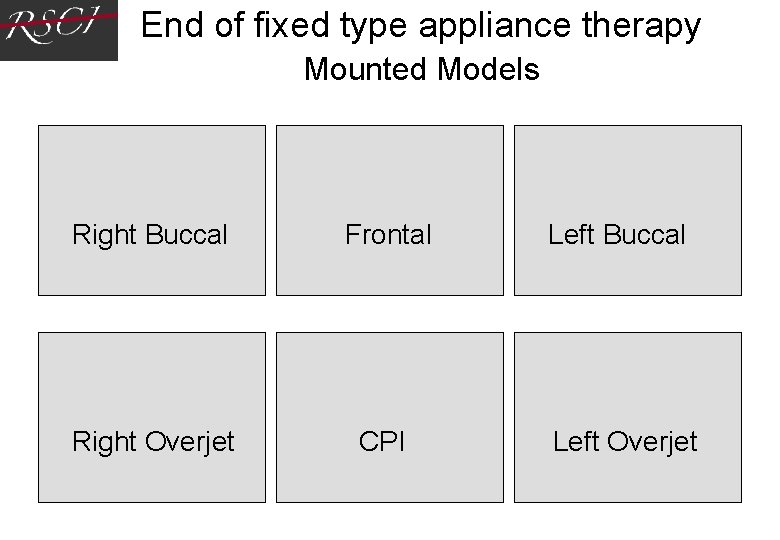 End of fixed type appliance therapy Mounted Models Right Buccal Frontal Left Buccal Right End of fixed type appliance therapy Mounted Models Right Buccal Frontal Left Buccal Right