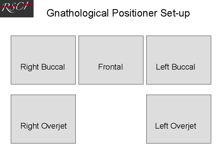 Gnathological Positioner Set-up Right Buccal Right Overjet Frontal Left Buccal Left Overjet Gnathological Positioner Set-up Right Buccal Right Overjet Frontal Left Buccal Left Overjet