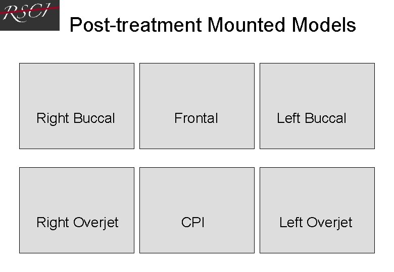 Post-treatment Mounted Models Right Buccal Frontal Left Buccal Right Overjet CPI Left Overjet Post-treatment Mounted Models Right Buccal Frontal Left Buccal Right Overjet CPI Left Overjet