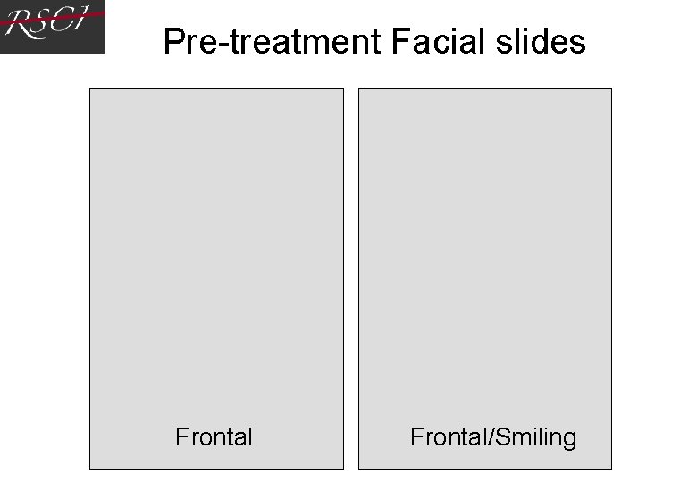 Pre-treatment Facial slides Frontal Frontal/Smiling Pre-treatment Facial slides Frontal Frontal/Smiling