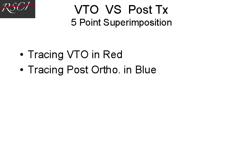 VTO VS Post Tx 5 Point Superimposition • Tracing VTO in Red • Tracing VTO VS Post Tx 5 Point Superimposition • Tracing VTO in Red • Tracing