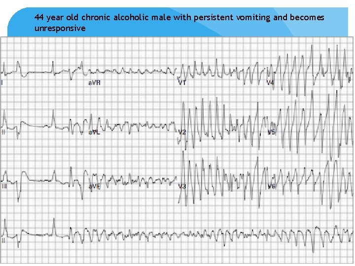 44 year old chronic alcoholic male with persistent vomiting and becomes unresponsive 