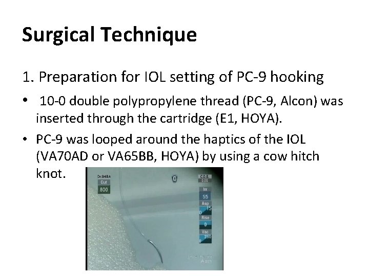 Surgical Technique 1. Preparation for IOL setting of PC-9 hooking • 10 -0 double