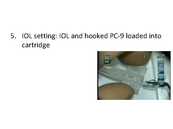 5. IOL setting: IOL and hooked PC-9 loaded into cartridge 