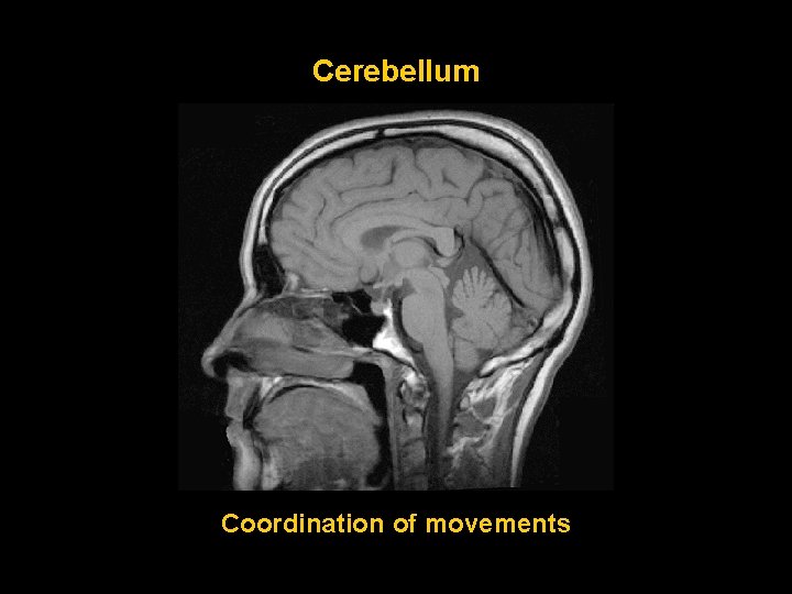 Cerebellum Coordination of movements 