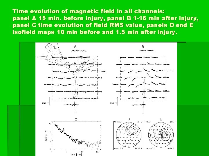 Time evolution of magnetic field in all channels: panel A 15 min. before injury,