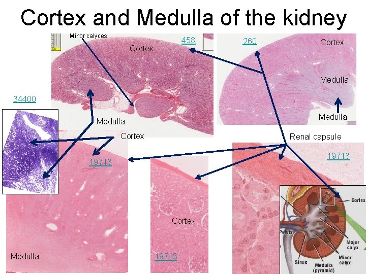 Cortex and Medulla of the kidney Minor calyces 458 Cortex 260 Cortex Medulla 34400