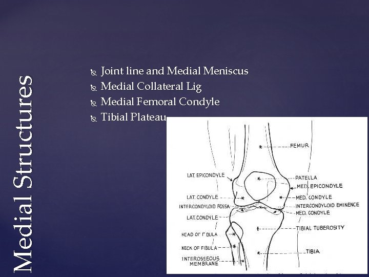 Medial Structures Joint line and Medial Meniscus Medial Collateral Lig Medial Femoral Condyle Tibial