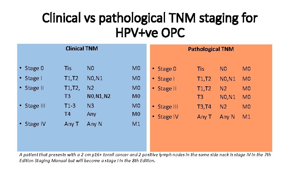 Clinical vs pathological TNM staging for HPV+ve OPC Clinical TNM Pathological TNM • Stage