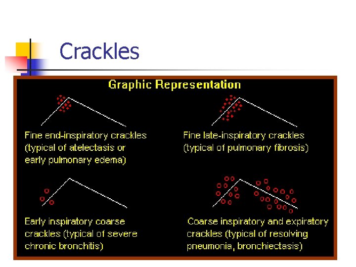 Crackles 