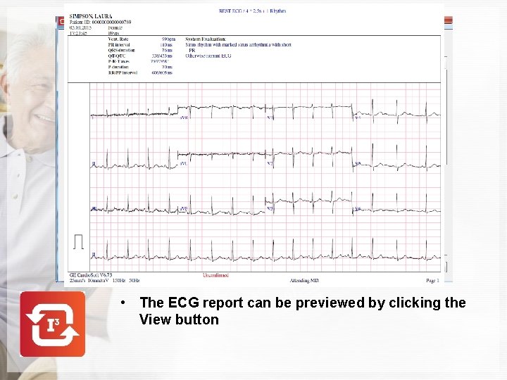  • The ECG report can be previewed by clicking the View button 