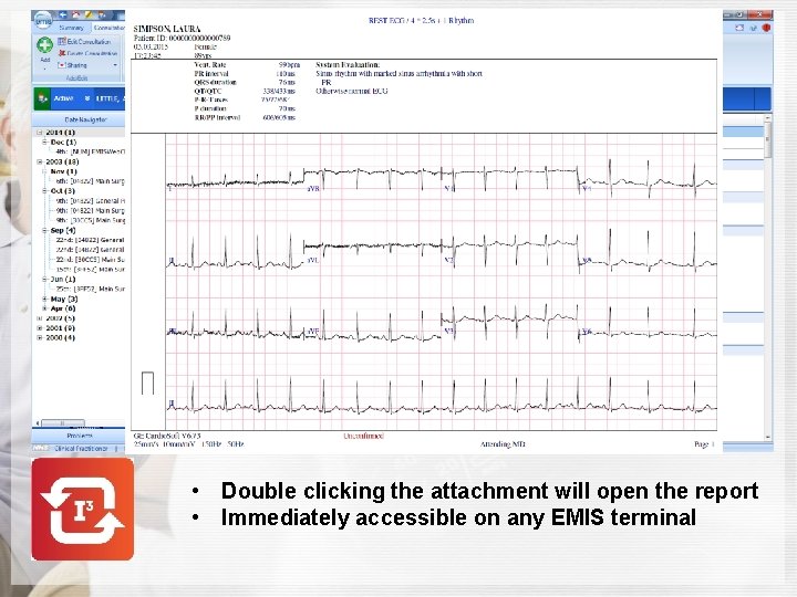  • Double clicking the attachment will open the report • Immediately accessible on
