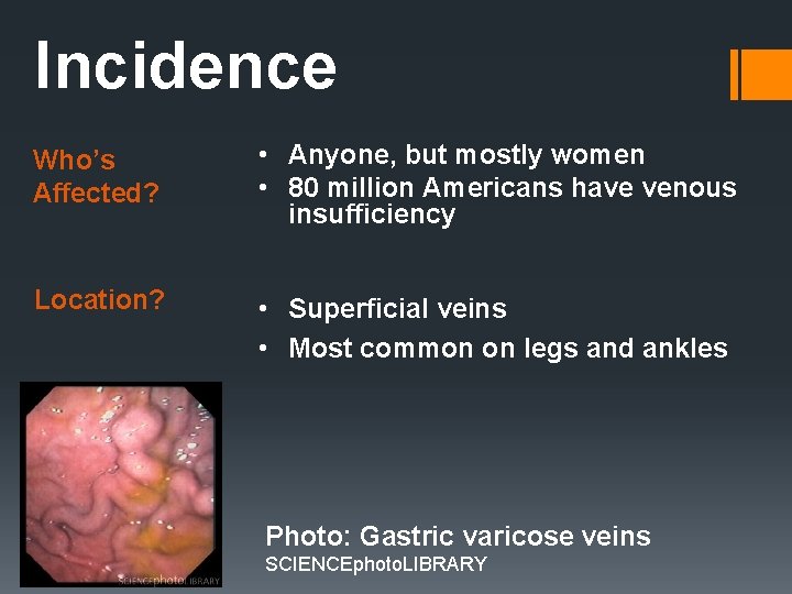 Incidence Who’s Affected? • Anyone, but mostly women • 80 million Americans have venous