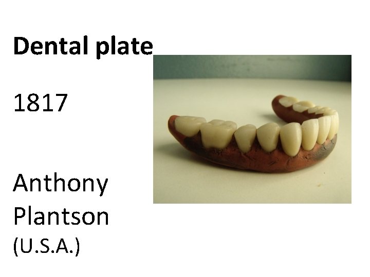 Dental plate 1817 Anthony Plantson (U. S. A. ) 