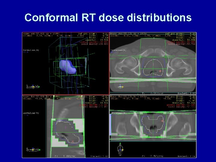 Conformal RT dose distributions 