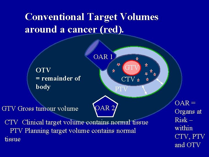 Conventional Target Volumes around a cancer (red). OAR 1 OTV = remainder of body