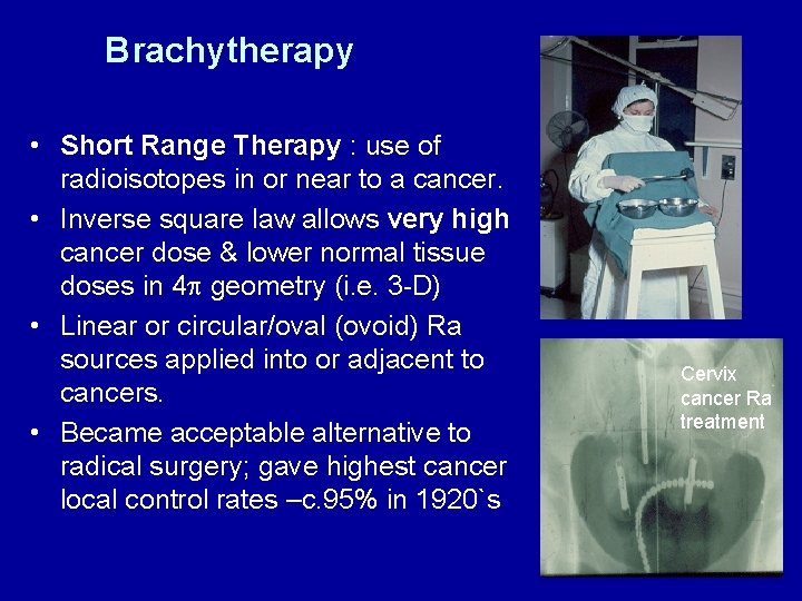 Brachytherapy • Short Range Therapy : use of radioisotopes in or near to a