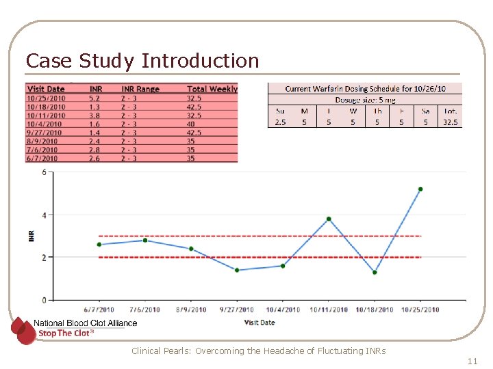 Case Study Introduction Clinical Pearls: Overcoming the Headache of Fluctuating INRs 11 