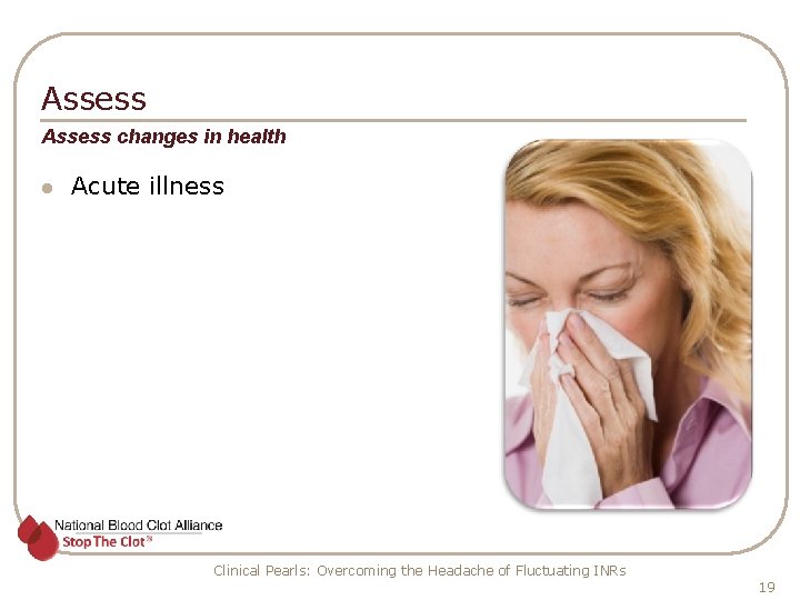 Assess changes in health l Acute illness Clinical Pearls: Overcoming the Headache of Fluctuating