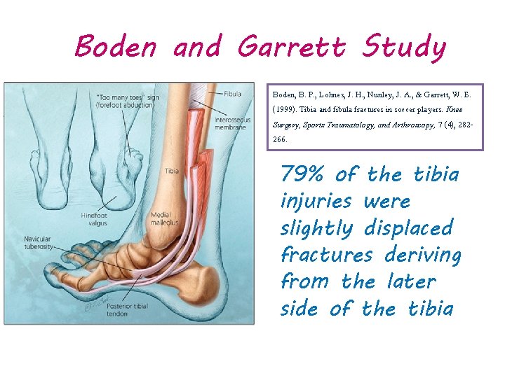 Boden and Garrett Study Boden, B. P. , Lohnes, J. H. , Nunley, J.