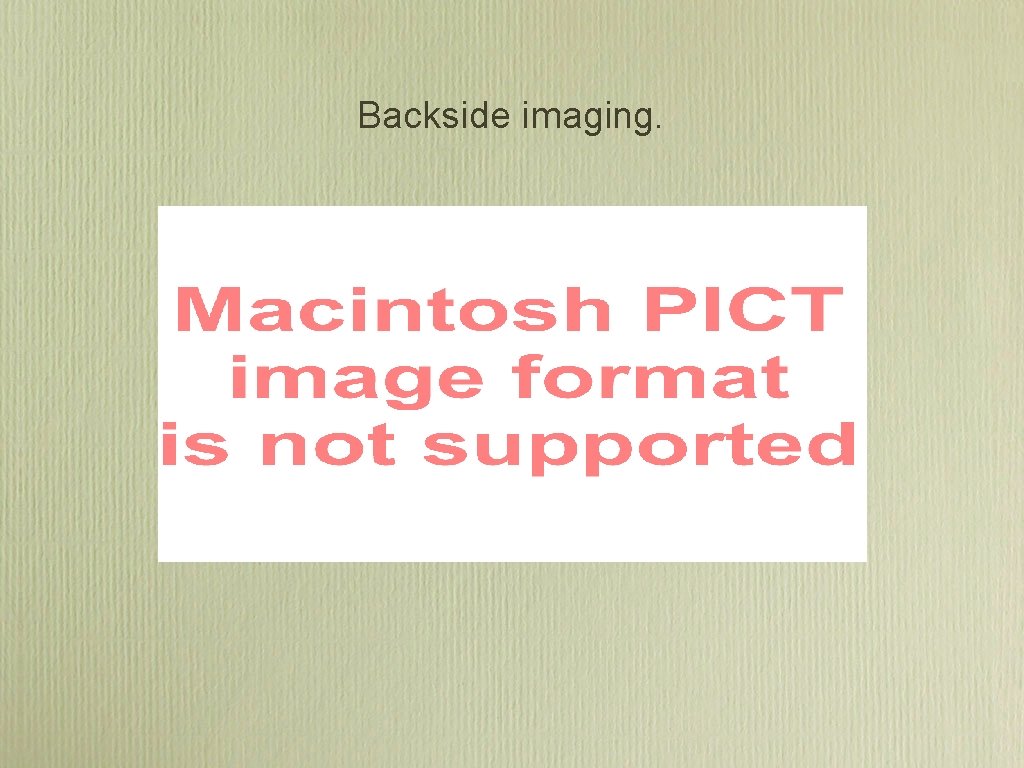 Backside imaging. Backside imaging.