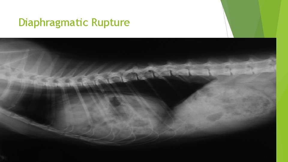 Diaphragmatic Rupture 