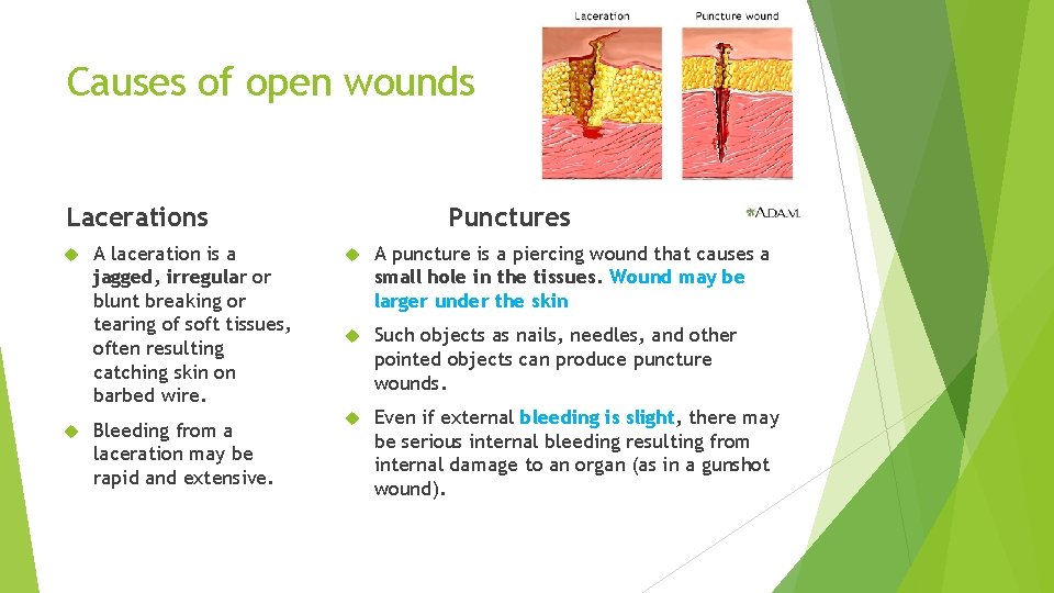 Causes of open wounds Lacerations A laceration is a jagged, irregular or blunt breaking