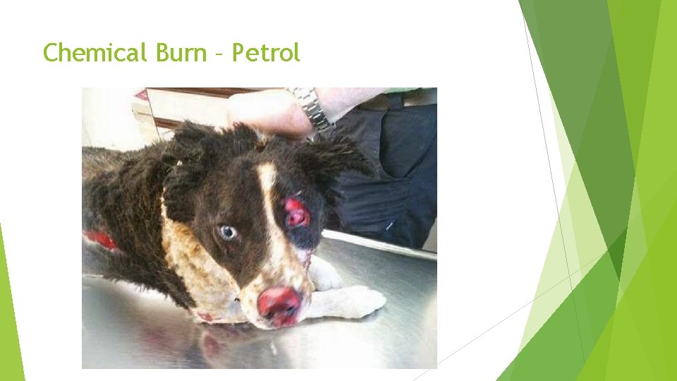 Chemical Burn – Petrol 