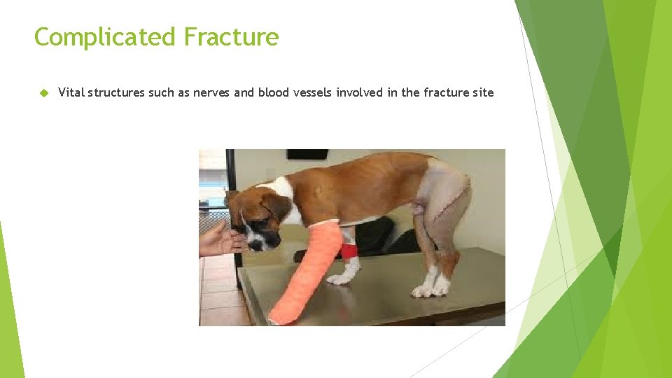 Complicated Fracture Vital structures such as nerves and blood vessels involved in the fracture