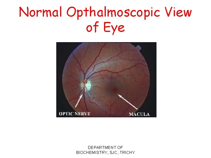 Normal Opthalmoscopic View of Eye DEPARTMENT OF BIOCHEMISTRY, SJC, TRICHY 