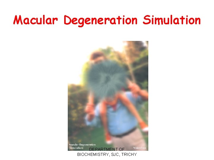 Macular Degeneration Simulation DEPARTMENT OF BIOCHEMISTRY, SJC, TRICHY 