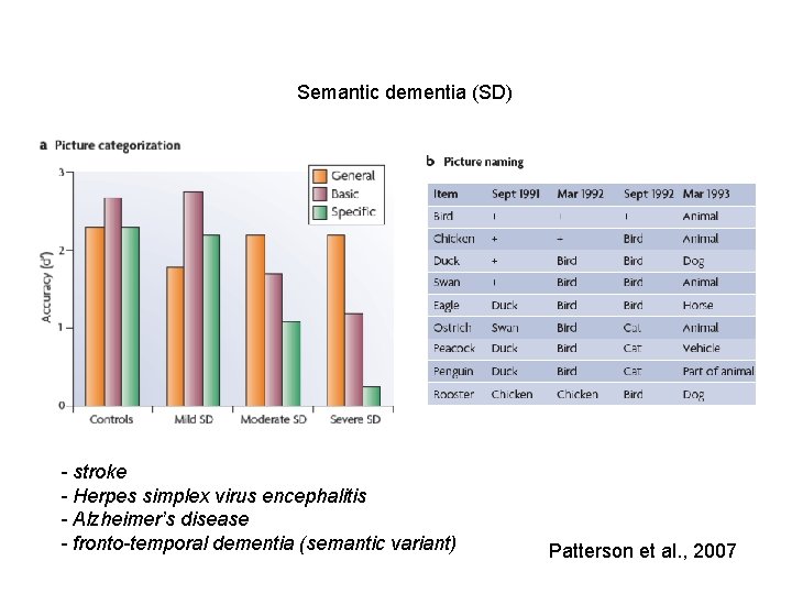 Semantic dementia (SD) - stroke - Herpes simplex virus encephalitis - Alzheimer’s disease -