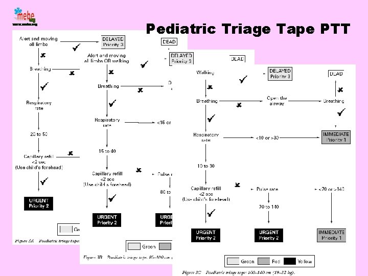 Pediatric Triage Tape PTT 