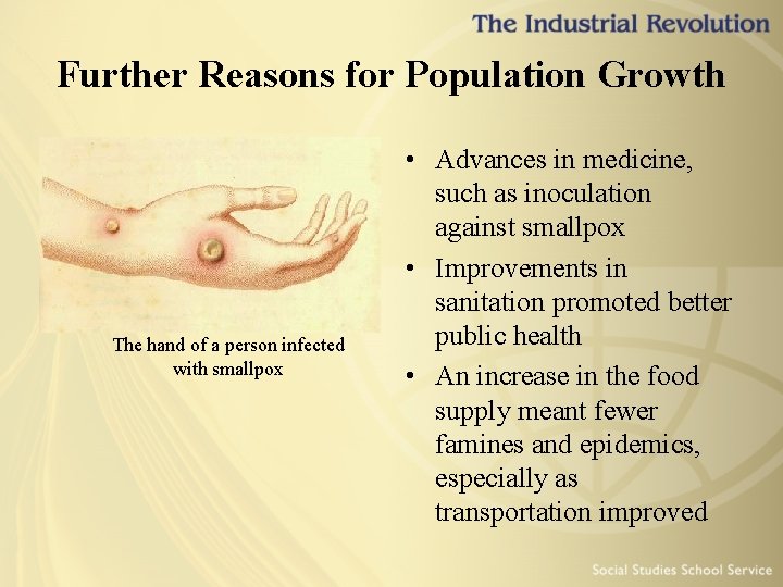 Further Reasons for Population Growth The hand of a person infected with smallpox •