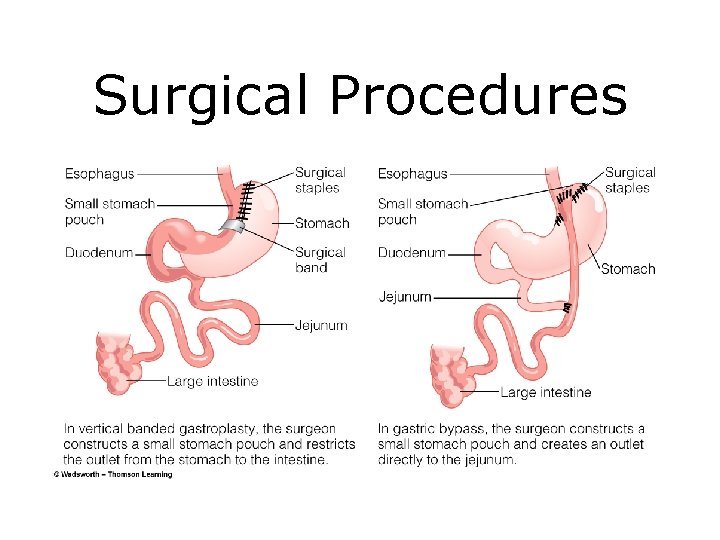 Surgical Procedures 