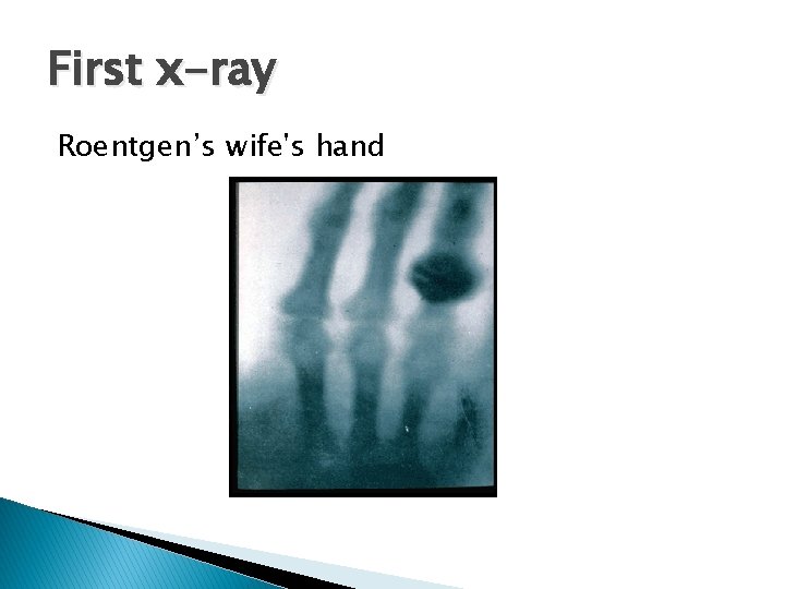 First x-ray Roentgen’s wife's hand 