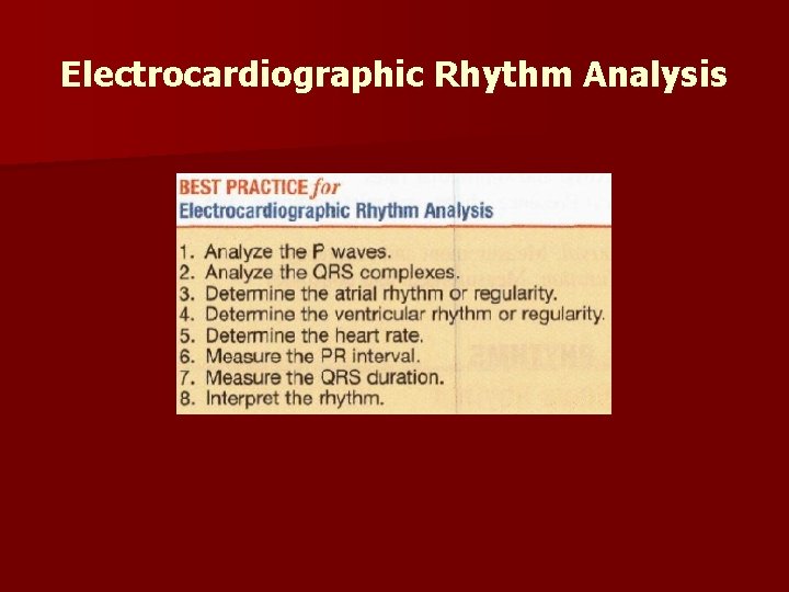 Electrocardiographic Rhythm Analysis 