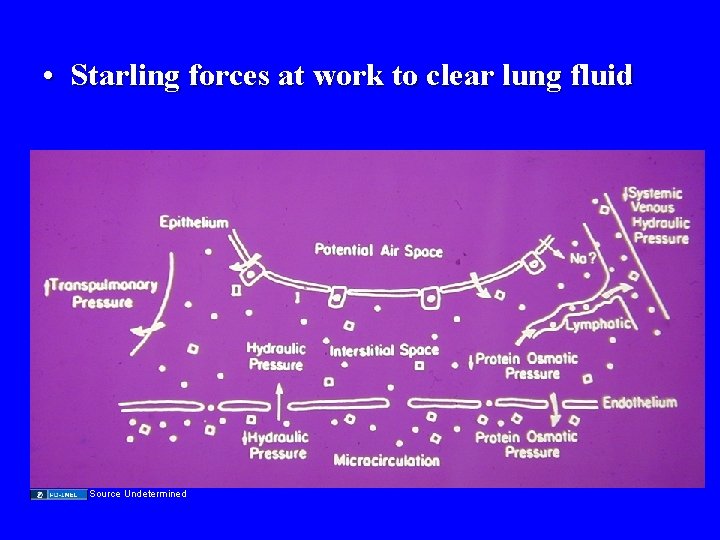  • Starling forces at work to clear lung fluid Source Undetermined 