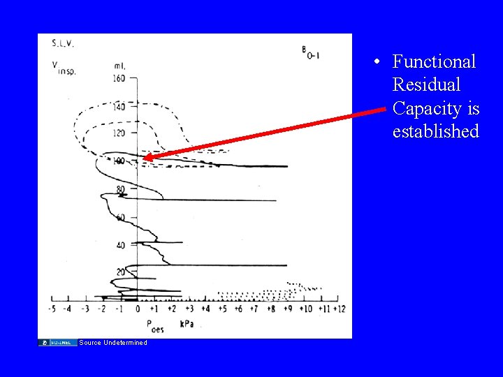  • Functional Residual Capacity is established Source Undetermined 