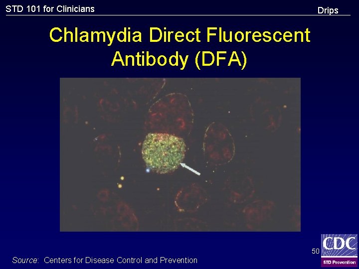 STD 101 for Clinicians Drips Chlamydia Direct Fluorescent Antibody (DFA) 50 Source: Centers for