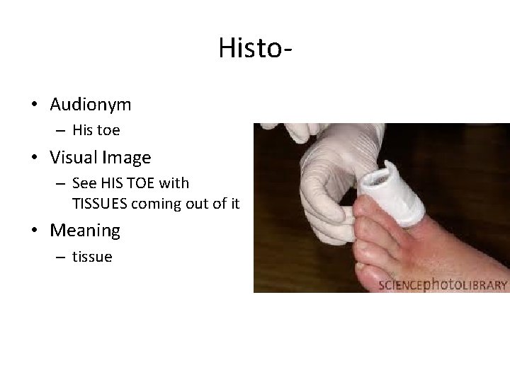 Histo • Audionym – His toe • Visual Image – See HIS TOE with