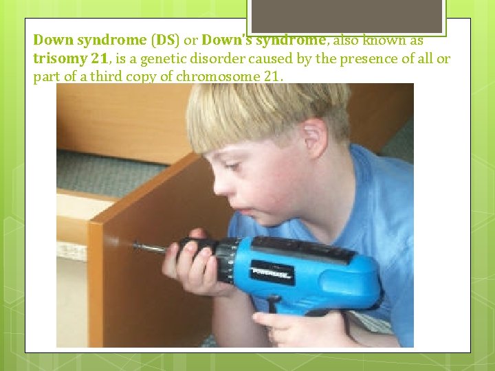 Down syndrome (DS) or Down's syndrome, also known as trisomy 21, is a genetic