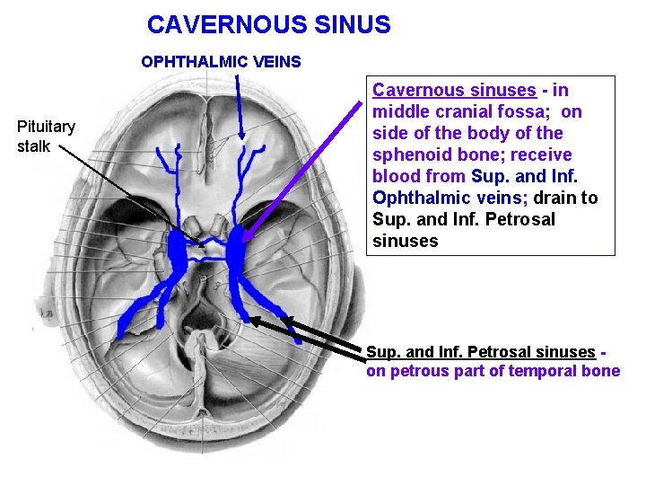 CAVERNOUS SINUS OPHTHALMIC VEINS Pituitary stalk Cavernous sinuses - in middle cranial fossa; on