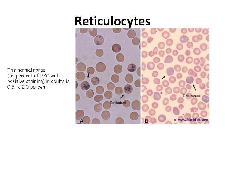 Reticulocytes The normal range (ie, percent of RBC with positive staining) in adults is