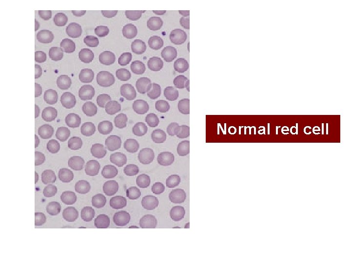 Normal red cell 