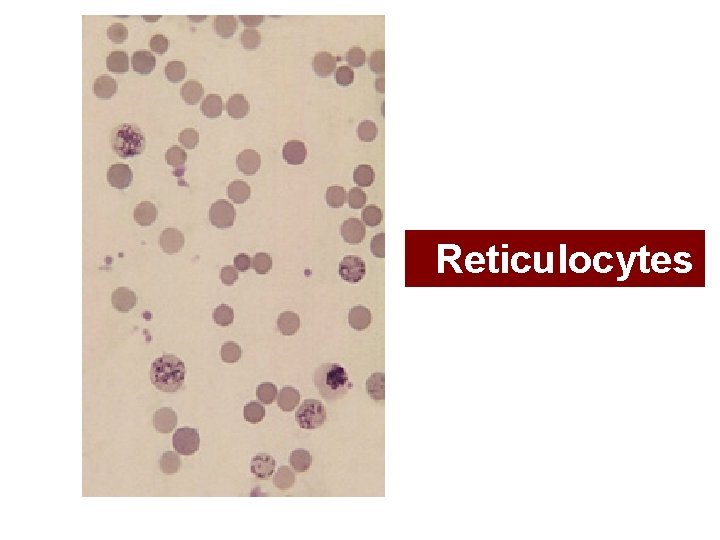 Reticulocytes 