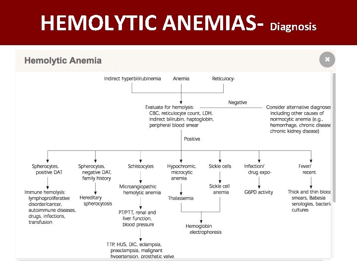 HEMOLYTIC ANEMIAS- Diagnosis 