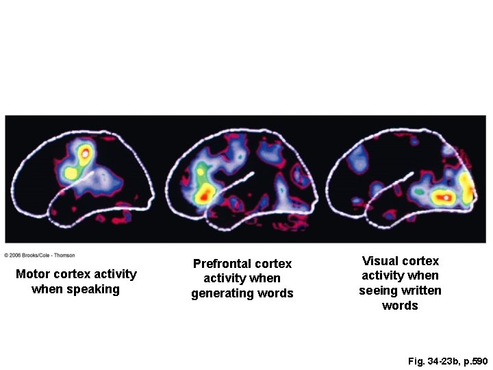 Motor cortex activity when speaking Prefrontal cortex activity when generating words Visual cortex activity Motor cortex activity when speaking Prefrontal cortex activity when generating words Visual cortex activity