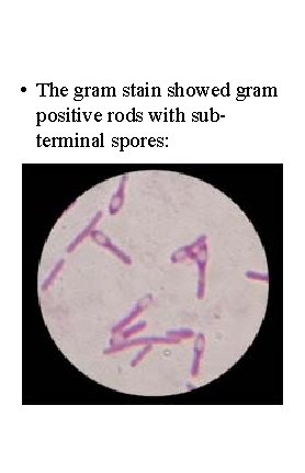  • The gram stain showed gram positive rods with subterminal spores: 